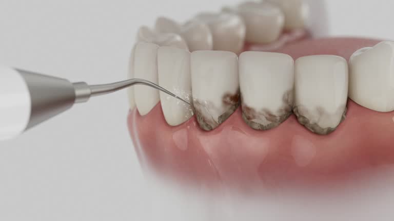Reliable Dental Implants contractor in Utica, MI by Smile Center Dentistry